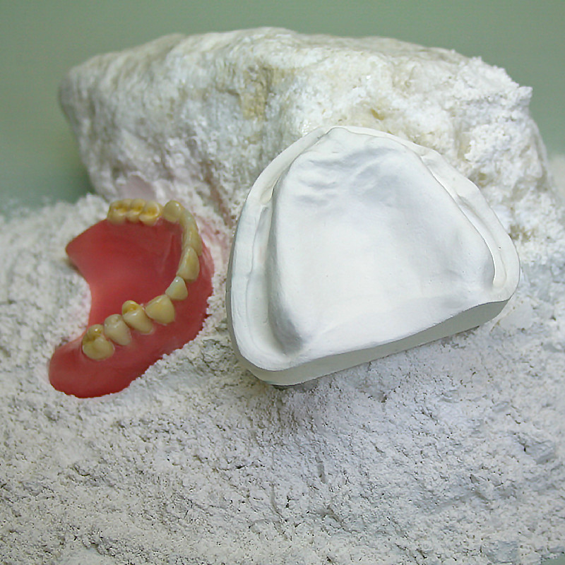 Gips dentystyczny klasa III. Neo Marmorit E Siladent – gips ekspansyjny do protez