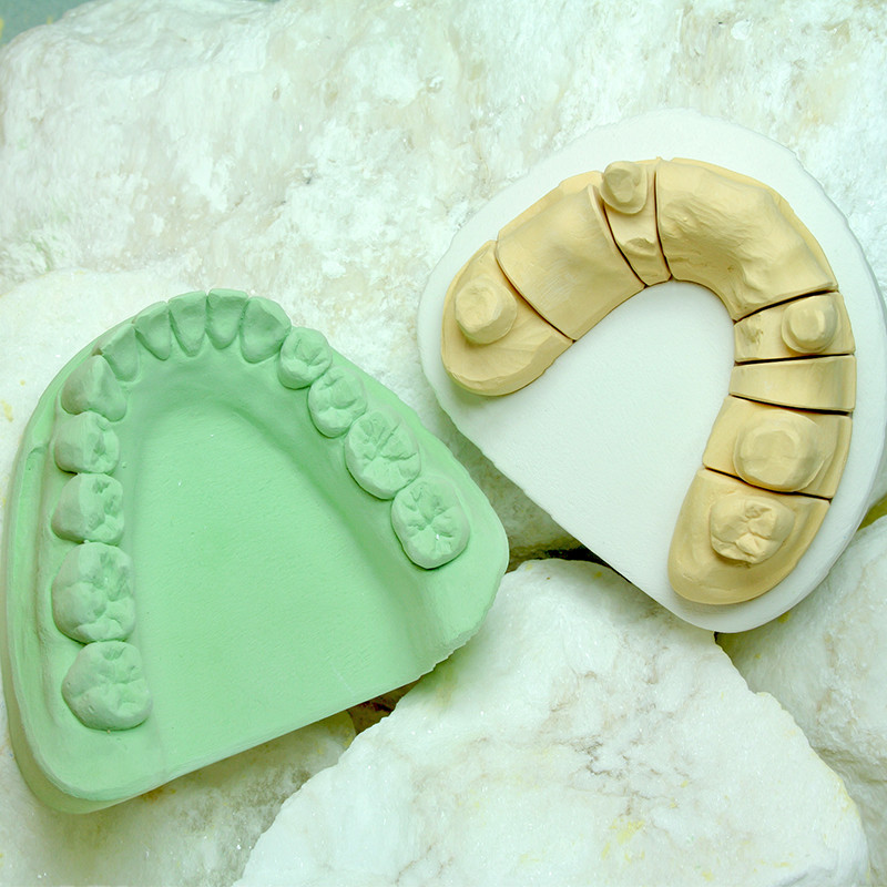Marmodie 22,7 kg klasa III– gips modelowy dla techników dentystycznych