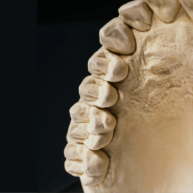 SHERAXTRA Gips dentystyczny IV klasy 18kg