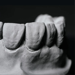 2SHERAXTRA Gips dentystyczny IV klasy 18kg