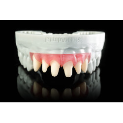 2SHERAprint-gingiva 500g