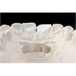 2SHERAREFRACT SHERA – materiał ogniotrwały do kikutów ceramicznych 990g